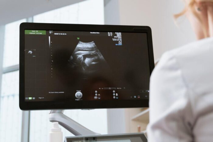 Abortos espontáneos: un tipo de pérdida común, pero que no es normal